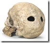 X_P_1- CRANI AMB TREPANACIONS