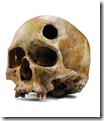 X_4- CRANI AMB TREPANACIO