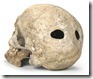 X _P_1- CRANI AMB TREPANACIONS